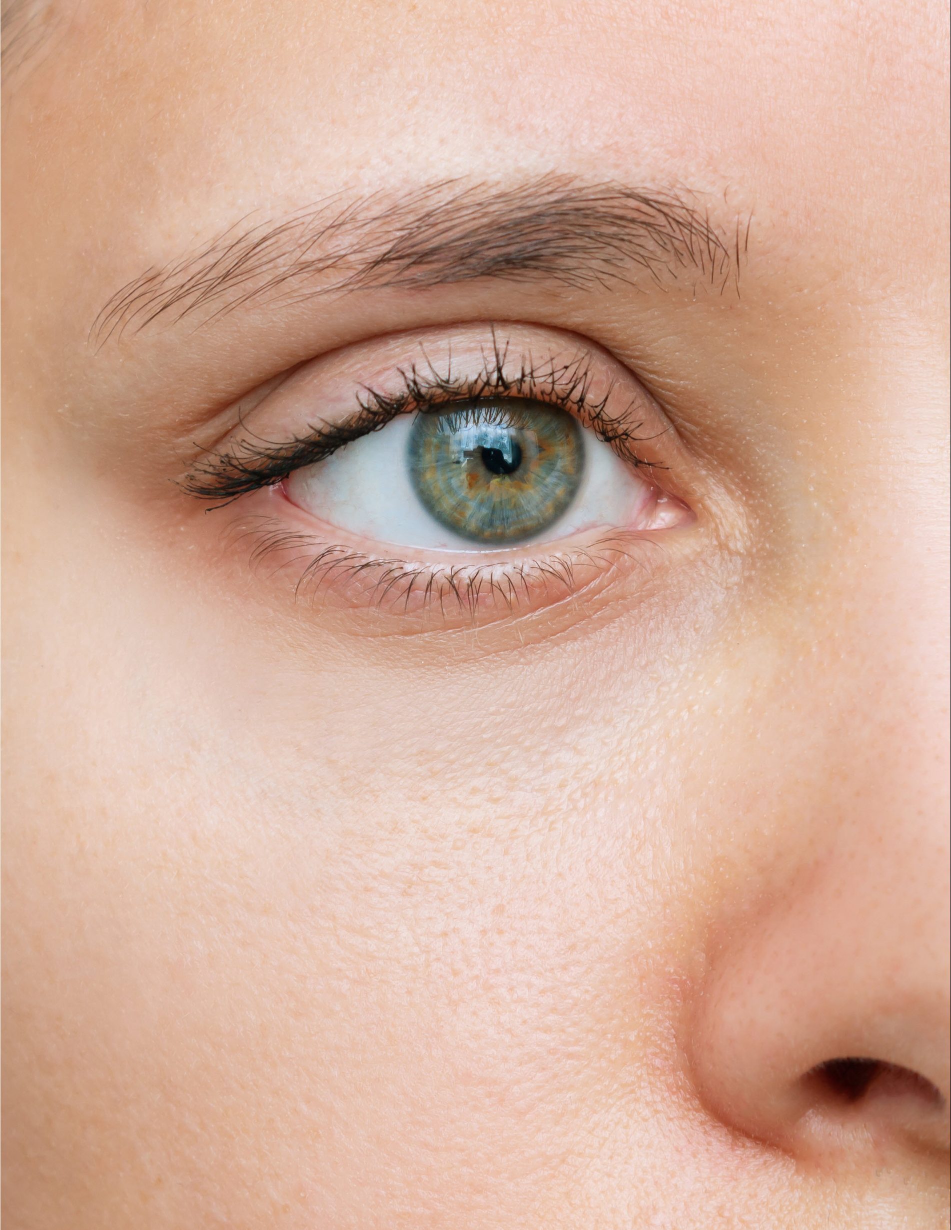 Eyelid After Treatment
